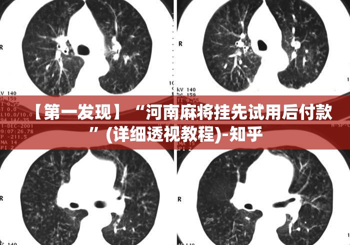 【第一发现】“河南麻将挂先试用后付款”(详细透视教程)-知乎