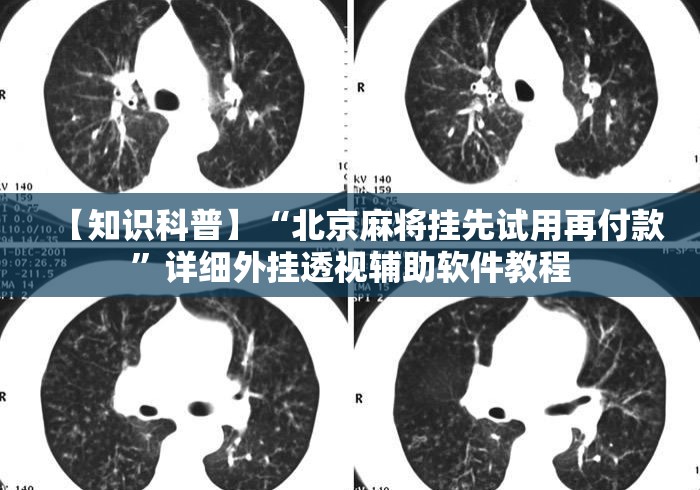 【知识科普】“北京麻将挂先试用再付款”详细外挂透视辅助软件教程
